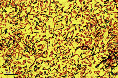 Unidentified Bacteria ©Josef Reischig / WikimediaCommons